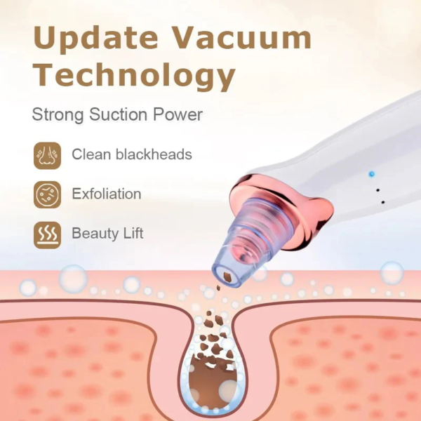 Blackhead Vacuum Pore Cleaner Blackhead Remover - Image 2