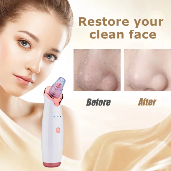 Blackhead Vacuum Pore Cleaner Blackhead Remover - Image 4