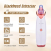 Blackhead Vacuum Pore Cleaner – Powerful Blackhead & Oil Removal | aizel Beauty Shop - Image 2