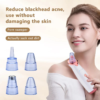Blackhead Vacuum Pore Cleaner – Powerful Blackhead & Oil Removal | aizel Beauty Shop - Image 6