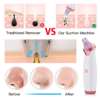 Blackhead Vacuum Pore Cleaner – Powerful Blackhead & Oil Removal | aizel Beauty Shop - Image 7